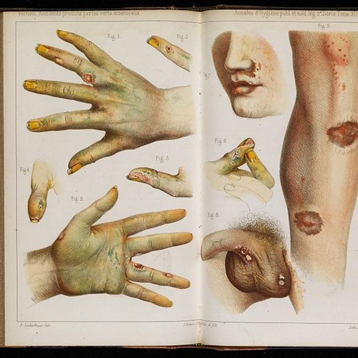 Objawy zatrucia farbą